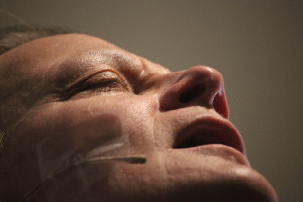 Nahaufnahme eines Frauengesichts während einer Behandlung mit Nadeln in der Nase, die Augen geschlossen, vor einer Wand.