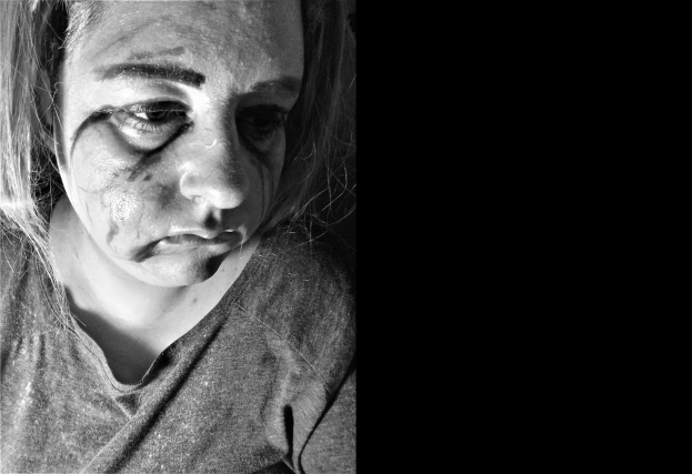 Schwarz-weiß-Foto einer Frau mit sichtbaren Gesichtsverletzungen, ernster Gesichtsausdruck, konzentrierter Blick, zurückgekämmtes Haar, trägt ein T-Shirt.
